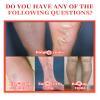 bobojuju Varicose Veins Relief Plasters, 2 - Pack (12Pcs) for Bulging Veins & Leg Discomfort, Plant - Based, Skin - Friendly view 4