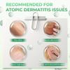 Atoskin Shower & Atoskin Serum - for Eczema, Psoriasis - Daily Body & Skin Care Duo with Botanical Extracts Helps Improve Dry, Flaky, Itchy Skin view 3