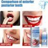 A1 A2 False Tooth Repair Kits for Filling The Missing Broken Tooth and Gaps-Moldable and Fake Teeth Thermal Beads Replacement Kits view 2