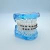 1 Pair of Temporary Tooth Decoration, Teeth Retainer Practical Brackets para Dientes Sturdy Retenedores de Dientes Ortodoncia Props for Dental Students to Practice (Black) view 4