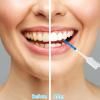 lanjue 250 Pieces Dental Floss Picks, Silicone Interdental Brushes with Case Dental Brushes Dental Picks Blue Tooth Floss Picks for Teeth Cleaning(Blue) view 3