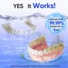 MySmile Dental Ultrasonic Retainer Cleaner Machine- 45kHz UV Denture Cleaner with 200ML Capacity for Aligner, Braces, Mouth Guard, Night Guard, Portable Dental Cleaning Pod with Digital Timer (White) view 2