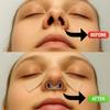 Nostril Retainer for Rhinoplasty Premium Medical Silicone Nose Shaper Maintains Shape and Symmetry First-Class Quality Comfortable Post-Surgery Support - Nose Retainer (6) view 3