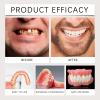 Silicone Full Denture Set, Moldable Dentures, Premium Dentures, Silicone Reline Denture Set, Denture Silicone Reline Kit (2) view 2