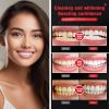 2 Pack sp6 Probiotic Whitening Toothpaste Adult,Fresh BreathTeeth Whitening,Fluoride Free, 6 Probiotics Formula for Gum Health,sp 6 probiotic Toothpaste whitening Nature Mint view 4