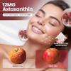 10 in 1 Astaxanthin Supplements 12mg, 16 Month Supply, Astaxantina Antioxidant from Fresh Haematococcus Pluvialis, Contains Lycopene, Grape Seed, Vitamin E, More Supports Eye, Joints, Skin Health 4Bag view 2