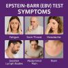 EBV at-Home Test Kit | Detects IgG Response to VCA & EBNA | 15-Minute Rapid Result | Easy Fingerstick Sample view 3