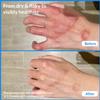 Auteli Natural Soothing Eczema Cream - Honey & Sea Moss - Organic Eczema Relief Cream - for Face & Body, Natural Dry Skin Repair (4 oz) view 2