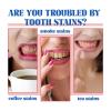 7.5% Hydroxyapatite Toothpaste(Fluoride Free), Nano Hydroxyapatite Toothpaste for Sensitive Teeth, Enamel Protection, Tooth Strengthening, Fresh Mint Flavor, Daily Use for Oral Care, 4.23 Oz view 2