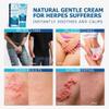 Roycederm Herpes Cream Soothes Itching, Redness, Discomfort, and Sensitive Areas Fast-Absorbing & Gentle Formula view 4