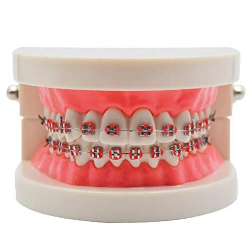 2020 Corrective Teeth Model,Corrective Dental Carrier Model Bracket Archwire Buccalocclusion Using Bacqual Tube Tools MA