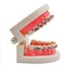 2020 Corrective Teeth Model,Corrective Dental Carrier Model Bracket Archwire Buccalocclusion Using Bacqual Tube Tools MA view 2