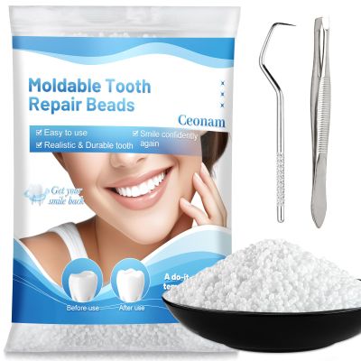 10.9oz Tooth Repair Beads - Teeth Replacement Kit for Temporary Restoration of Missing and Broken Teeth, DIY Heat Fit Beads for Denture Repair and Oral Care