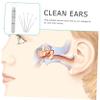 Anneome Stainless Steel Earwax Removal Kit Portable Ear Picks Spiral Design Comfortable Ear Cleaning Lightweight Easy to Clean view 3