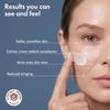Serica Moisturizing Rosacea Formula (1 Oz), Helps Reduce Redness, Soothe Irritation, Improve Skin Texture & Tone, Homeopathic Face Moisturizer with Ceramides, Fatty Acids & Amazonian Oils view 3
