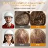 Red Light Therapy for Hair Growth - FDA Cleared Laser Cap for Hair Regrowth, Hair Loss Thinning & Alopecia Treatment for Men & Women, Wireless Rechargeable Model Hat-01 (White) view 2