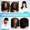 2026 Upgrade Wireless Laser Cap for Hair Regrowth,Rechargeable Red Light Therapy for Hair Growth view 4