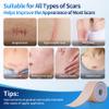 HBM Medical Grade Silicone Scar Tape, Scar Silicone Strips,Silicone Scar Sheets for Surgical Scars, C-Section, Keloid, Burn, Acne, Reusable Scar Removal Tape for Old & New Scars (4 x 150 cm) view 2