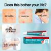 Anisx High-Efficiency Eczema Psoriasis Dermatitis Creams, Eczema Relief Hydrocortisone Fast-Acting Itch, Dermatitis and Rash Treatment, Soothes Sensitive Dry Skin, with Natural Herbal Extracts 0.7 oz view 2
