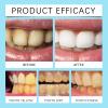 Denture Cleaning Effervescent TabletsAdjusts PH Balance, Enhance Cleaning Power, Soak And Rinse For Easy Use, Suitable For Denture Adhesives(4pcs) view 2