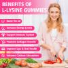 YUULAI Pack of 2 L-Lysine 1000mg Gummies for Adults & Kids, Essential Amino Acid Supplement for Lips & Oral Health, Boost Immune & Collagen & Calcium, Sugar-Free, Raspberry Flavor, 120 Count view 3