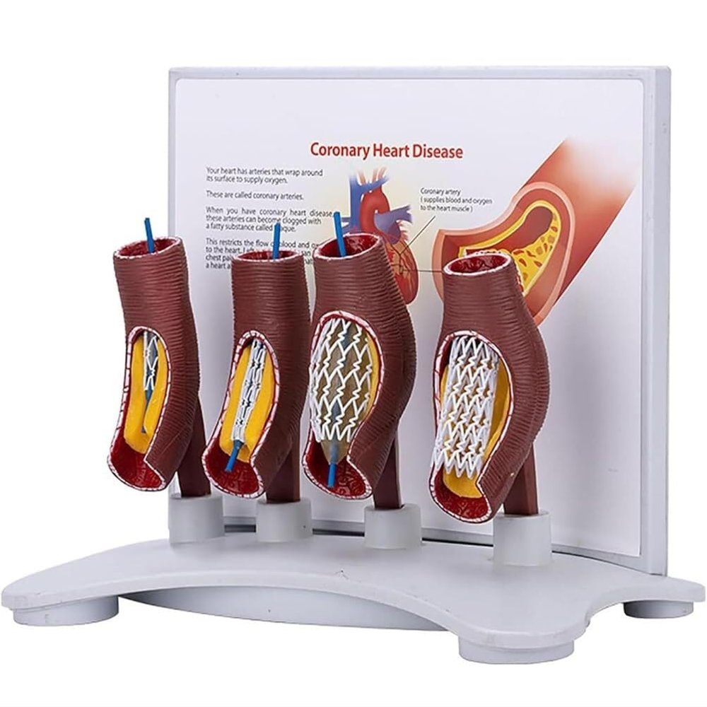 Human Coronary Stent Model, Vascular Blockage Model, Vascular Stent Anatomical Model, Human Vessel Enlargement Demonstration Model