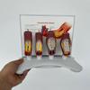 Human Coronary Stent Model, Vascular Blockage Model, Vascular Stent Anatomical Model, Human Vessel Enlargement Demonstration Model view 3