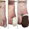 BOUNCEBACK BIG TOE Protective Socks Soft Cotton Medical Sleeve for Ingrown Toenails | Diabetic Ulcers | Non-Slip Inner Grip | Brown | Small-Medium view 4