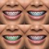 4 Rolls Power Chain for Braces with Changing Kit (Orthodontic Pliers and Probe), Continuous Rubber Braces Power chains, DIY Dental Braces Color Change at Home (Blue, Green, Pink, Purple) view 4