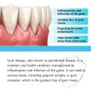 2pcs Gum Restore Drop for Adults - Gum Repair Regrowth for Receding Gums Treatment & Stain Removal Natural, Bad Breath Treatment & Fresh Breath & 30ml Portable Oral Care Solution view 4