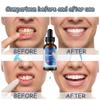 3pcs Gum Restore Drop for Adults - Gum Repair Regrowth for Receding Gums Treatment & Stain Removal Natural, Bad Breath Treatment & Fresh Breath & 30ml Portable Oral Care Solution view 3
