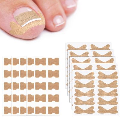 10pcs Nail Repair Patches, Ingrown Toenail Corrector Patch, Breathable Ingrown Toenail Strips, Ingrown Toenail Corrector Tool Foot Care Strips, No-Glue Toenails Support Tool Correction for At-Home