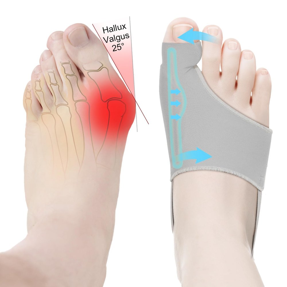 2PCS Bunion Corrector for Women & Men Big Toe Straightener - Bunions Correction Tool for - Bunion Splint with Soft Pads - Hallux Valgus Pain Relief, Breathable Fabric for Day & Night Wear (1, Gray)