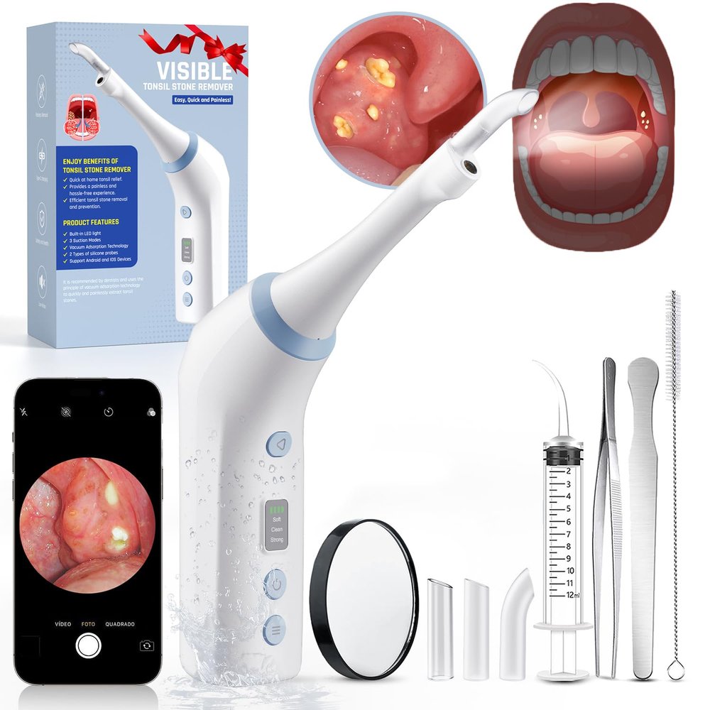 2026 Upgraded Electric Tonsil Stone Remover with 1080P CameraTonsil Stone Removal Kit with LED Light900mAh Tonsil Stone Vacuum Oral Care for Mouth Health & Painless Cleaning