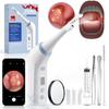 2026 Upgraded Electric Tonsil Stone Remover with 1080P CameraTonsil Stone Removal Kit with LED Light900mAh Tonsil Stone Vacuum Oral Care for Mouth Health & Painless Cleaning view 1