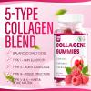 AQILUN Collagen Peptides Gummies, Collagen Gummies for Women with Type I, II, III, V, X Collagen Peptides, Biotin,& Multivitamins, Promote Skin,Hair,Nail Health view 2