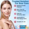 Scar Butter Stick, Scar Cream with Vitamin E & Cocoa Butter for Scars, Fade Scars, Deeply Moisturize, Light & Non-greasy, Scar Repair Stick for Old and Recent Scars and Stretch Marks | 20g view 2