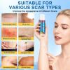 Scar Butter Stick, Scar Cream with Vitamin E & Cocoa Butter for Scars, Fade Scars, Deeply Moisturize, Light & Non-greasy, Scar Repair Stick for Old and Recent Scars and Stretch Marks | 20g view 4