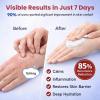 2026 Upgrade Eczema CreamGMP Certified - Maximum 1% Hydrocortisone StrengthEczema Relief CreamNO.1-24H Deep SoothingFast-Acting Skin Recovery Tech for Rash, Redness, Inflammation & Bug Bites,20PCS view 3