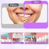 6 Pcs Soft Interdental Brushes 2-in-1 Toothbrush with Interdental and Teeth Brush Heads Orthodontic Toothbrushes Tiny Tuft Toothbrush Two in One Double Head for Interspace Braces Detail Cleaning Care view 4