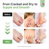 SAVILAND Antifungal Cream 120g Extra Strength: Max 25% Undecylenic Acid Fungal Cream for Skin Athletes Foot Jock Itch Ringworm Foot Fungus Treatment Natural Skin Relief with Tea Tree & Oregano Oil view 3