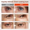 Viconor Red Light Therapy for Eyes, Comfort Under Eye Red Light Therapy view 2