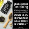 Probiotics for Hair Growth + Biotin 10000mcg - High Strength Hair Vitamins for Women and Men with Lactobacillus Reuteri & Clinically Studied Probiotic Strains - Supports Thicker, Fuller Scalp - Vegan view 4