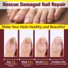 Toenail Fungus Treatment Extra Strength, Nail Fungus Treatment for Yellow, Thick, Discolored, Broken Nails, Ultimate Nail Repair Bk-2 view 4