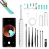 ALLENIC Ear Wax Removal Tool Camera, Ear Cleaner with Camera, Ear Wax Removal Kit, 1080P HD Ear Camera, Earwax Removal Kit with Camera and 6 LED Light, 8 Ear Pick & Ear Set for iOS & Android, White view 1