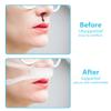 10 PCS Nasal Dressing Holders - Elastic External Nose Mesh Wound Bandage, Nasal Packing Retainers with Cotton Core, Post-Op Support Supplies view 4