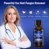 Toe Nail Fungus Renewal, 2-Pack Toenail Fungus Renewal, Fast Acting For Thick, Discolored, Broken & Damaged Toe & Finger Nail view 3