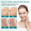 Scar Cream Silicone Scar Gel, Powerful Scar Removal Cream for Old & New Scars, Helps Reduce Surgical Scars, Acne, Burn, Keloids & Stretch Marks, 1.76 oz (50g) view 4