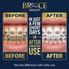 Teeth Whitening for Braces, Braces Cleaner Foam, Brace Teeth Whitening kit for Under Metal, Ceramic, Brackets & Wires. Use w/Toothbrush or Trays No Sensitivity. Minty, Teens, Adults, Refill 2 Pack view 3