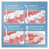 4Pcs Water Flosser Replacement TipsCompatible For MornwellF18/D52/F27/F09/F22/F23/F29/F32 Water Flosser Oral Irrigator,Nozzles(4black MIXED) view 2